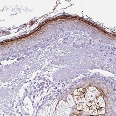 Immunohistochemistry-Paraffin: Corneodesmosin Antibody [NBP2-37942]