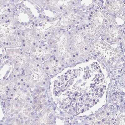 Immunohistochemistry-Paraffin: Corneodesmosin Antibody [NBP2-37942]