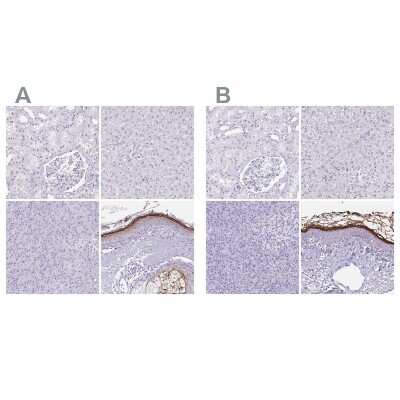Immunohistochemistry-Paraffin: Corneodesmosin Antibody [NBP2-37942]