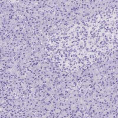 Immunohistochemistry-Paraffin: Corneodesmosin Antibody [NBP2-47501]