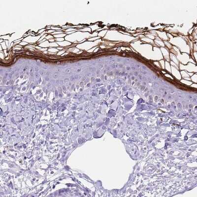 Immunohistochemistry-Paraffin: Corneodesmosin Antibody [NBP2-47501]