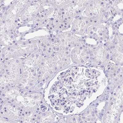 Immunohistochemistry-Paraffin: Corneodesmosin Antibody [NBP2-47501]