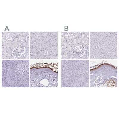 Immunohistochemistry-Paraffin: Corneodesmosin Antibody [NBP2-47501]