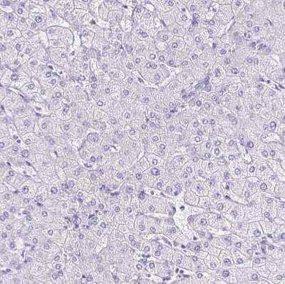 Immunohistochemistry-Paraffin: Corneodesmosin Antibody [NBP2-47501]