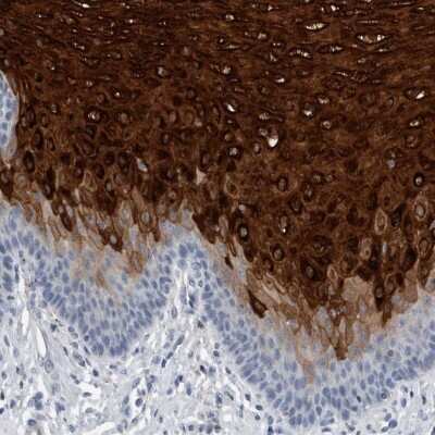 Immunohistochemistry-Paraffin: Cornulin Antibody [NBP1-88479]