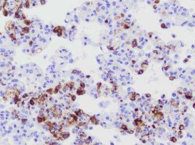 Immunohistochemistry-Paraffin: Coronavirus Antibody (FIPV3-70) - BSA Free [NB100-64754]