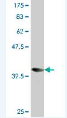 Western Blot: Coronin-1a Antibody (1A8) [H00011151-M03]
