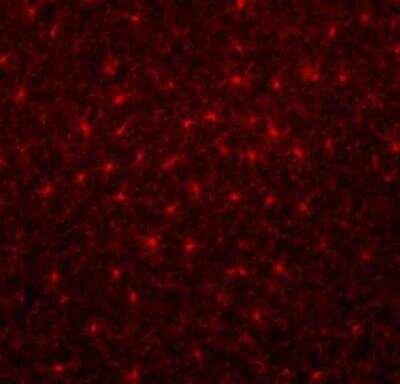 Immunocytochemistry/ Immunofluorescence: Coronin-1a Antibody [NB110-58367]