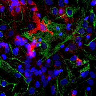 Immunocytochemistry/ Immunofluorescence: Coronin-1a Antibody [NB110-58867]
