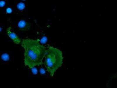 Immunocytochemistry/ Immunofluorescence: Coronin-1a Antibody (OTI1A5) - Azide and BSA Free [NBP2-71680]