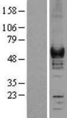 Western Blot: Coronin-1a Overexpression Lysate [NBL1-09395]