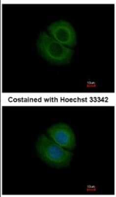 Immunocytochemistry/ Immunofluorescence: Coronin-2B Antibody [NBP2-15969]