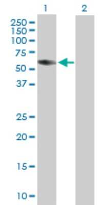 Western Blot: Coronin-2B Antibody [H00010391-B01P]
