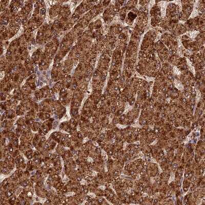 Immunohistochemistry-Paraffin: Coronin 3 Antibody [NBP1-85506]