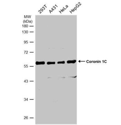 Western Blot: Coronin 3 Antibody [NBP1-31283]