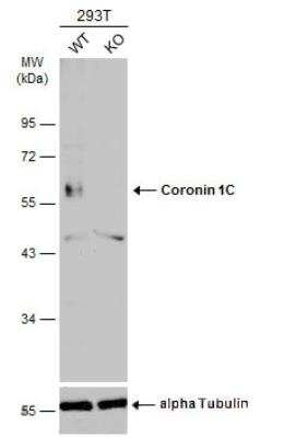 Western Blot: Coronin 3 Antibody [NBP1-31283]