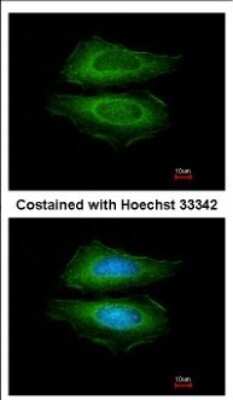 Immunocytochemistry/ Immunofluorescence: Cortactin Antibody [NBP2-15972]