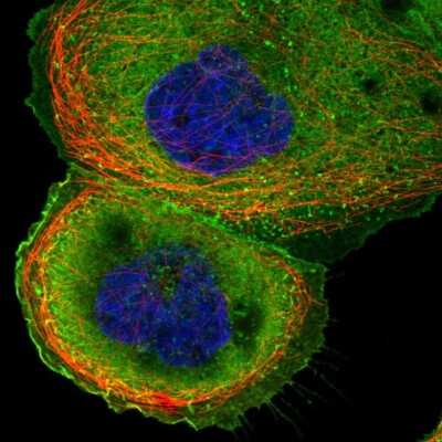 Immunocytochemistry/ Immunofluorescence: Cortactin Antibody [NBP2-38826]