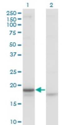 Western Blot: Corticotropin Releasing Factor Antibody (2B11) [H00001392-M02]