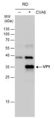 Western Blot: Coxsackievirus A6 VP1 Antibody [NBP3-13092]