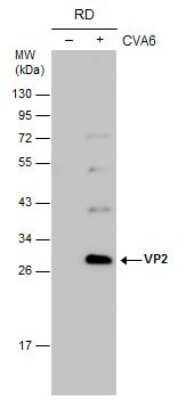 Western Blot: Coxsackievirus A6 VP2 Antibody [NBP3-13093]