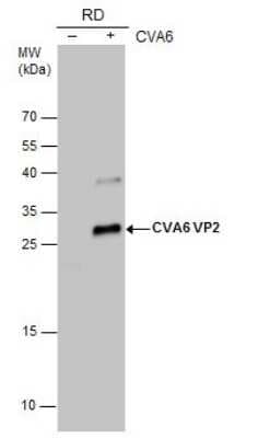 Western Blot: Coxsackievirus A6 VP2 Antibody [NBP3-13094]