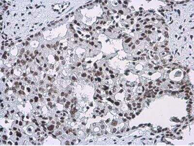 Immunohistochemistry-Paraffin: Craniofacial Development Protein 1 Antibody (11811) [NBP2-43772]