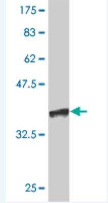 Western Blot: Craniofacial Development Protein 1 Antibody (5B7) [H00010428-M04]