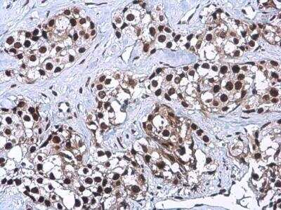 Immunohistochemistry-Paraffin: Craniofacial Development Protein 1 Antibody (9612) [NBP2-43759]