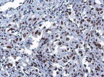 Immunohistochemistry-Paraffin: Craniofacial Development Protein 1 Antibody (9612) [NBP2-43759]