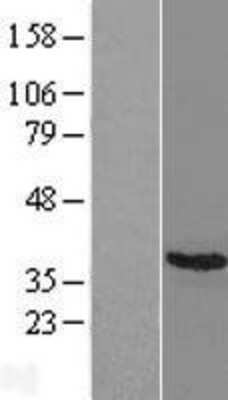 Western Blot: Craniofacial Development Protein 1 Overexpression Lysate [NBL1-09120]