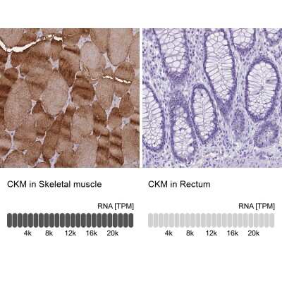 Immunohistochemistry-Paraffin: Creatine Kinase, Muscle/CKMM Antibody [NBP2-13839]