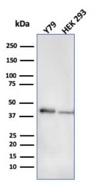 Western Blot: Creatine Kinase BB Antibody (CPTC-CKB-2)Azide and BSA Free [NBP3-08866]