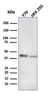 Western Blot: Creatine Kinase BB Antibody (CPTC-CKB-2) [NBP3-07542]
