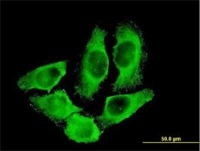 Immunocytochemistry/ Immunofluorescence: Creatine Kinase, Muscle/CKMM Antibody (1E3) [H00001158-M02]