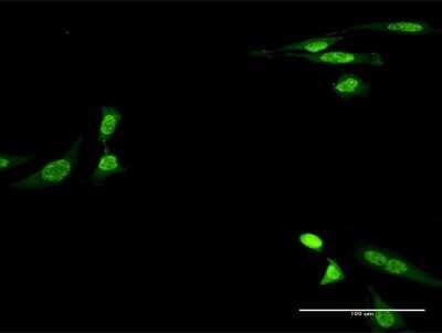 Immunocytochemistry/ Immunofluorescence: Creatine Kinase, Muscle/CKMM Antibody (2F3-B11) [H00001158-M06]