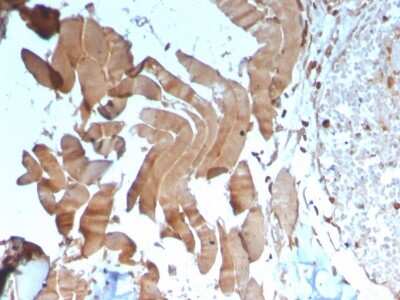 Immunohistochemistry-Paraffin: Creatine Kinase, Muscle/CKMM Antibody (CKMM/3341) - Azide and BSA Free [NBP3-08304]