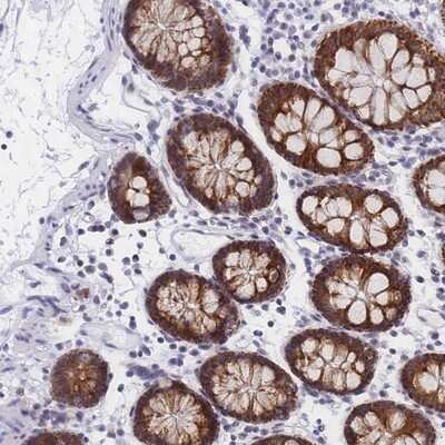 Immunohistochemistry-Paraffin: Creatine kinase MT 1A Antibody [NBP2-13840]
