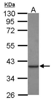 Western Blot: Creatine kinase MT 1A Antibody [NBP2-16004]