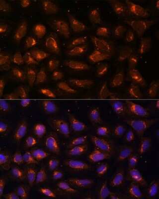 Immunocytochemistry/ Immunofluorescence: Creatine kinase MT 1B Antibody - Azide and BSA Free [NBP3-05655]