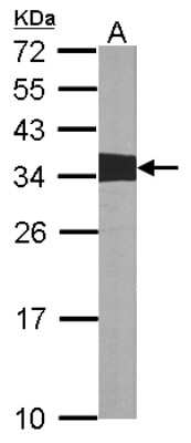 Western Blot: Crk Antibody [NBP1-32044]