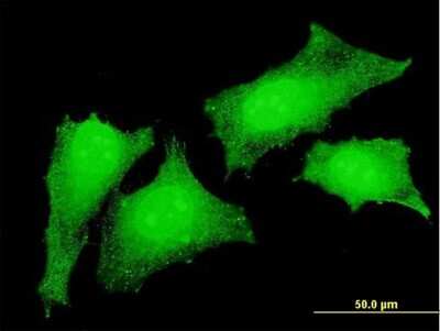 Immunocytochemistry/ Immunofluorescence: CrkL Antibody (4B5) [H00001399-M03]