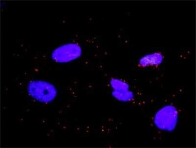 Immunocytochemistry/ Immunofluorescence: CrkL Antibody (4B5) [H00001399-M03]