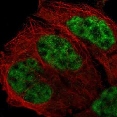 Immunocytochemistry/ Immunofluorescence: CrkRS Antibody [NBP1-85451]