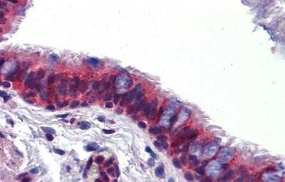 Immunohistochemistry-Paraffin: Crossveinless-2/CV-2/BMPER Antibody [NBP1-58041]