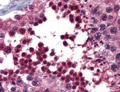 Immunohistochemistry-Paraffin: Crossveinless-2/CV-2/BMPER Antibody [NBP1-58041]
