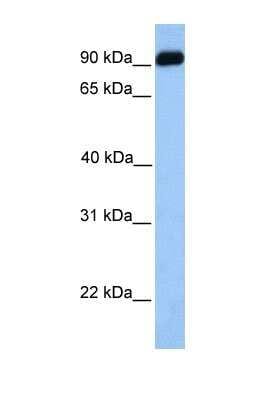Western Blot: Crossveinless-2/CV-2/BMPER Antibody [NBP1-58041]