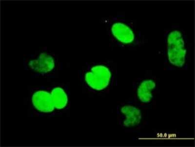 Immunocytochemistry/ Immunofluorescence: CtBP1 Antibody (2G7) [H00001487-M01]