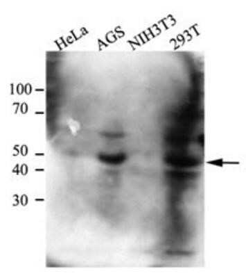 Western Blot: CtBP1 Antibody (4D6)BSA Free [NBP1-74040]