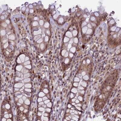 Immunohistochemistry-Paraffin: CtIP Antibody [NBP1-85384]